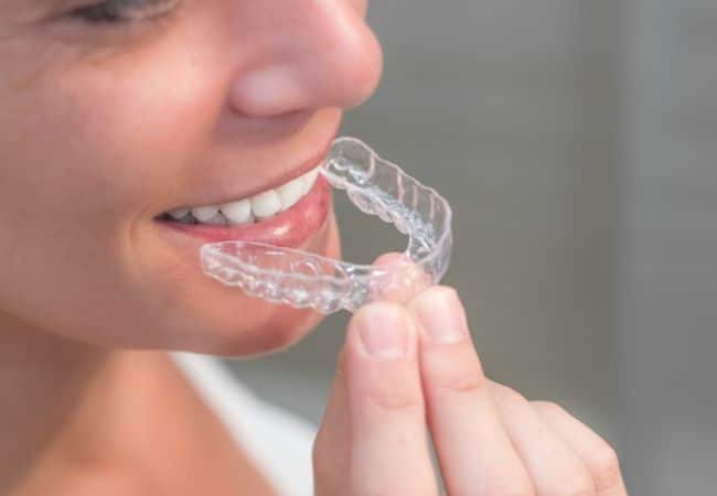 יישור שיניים למבוגרים